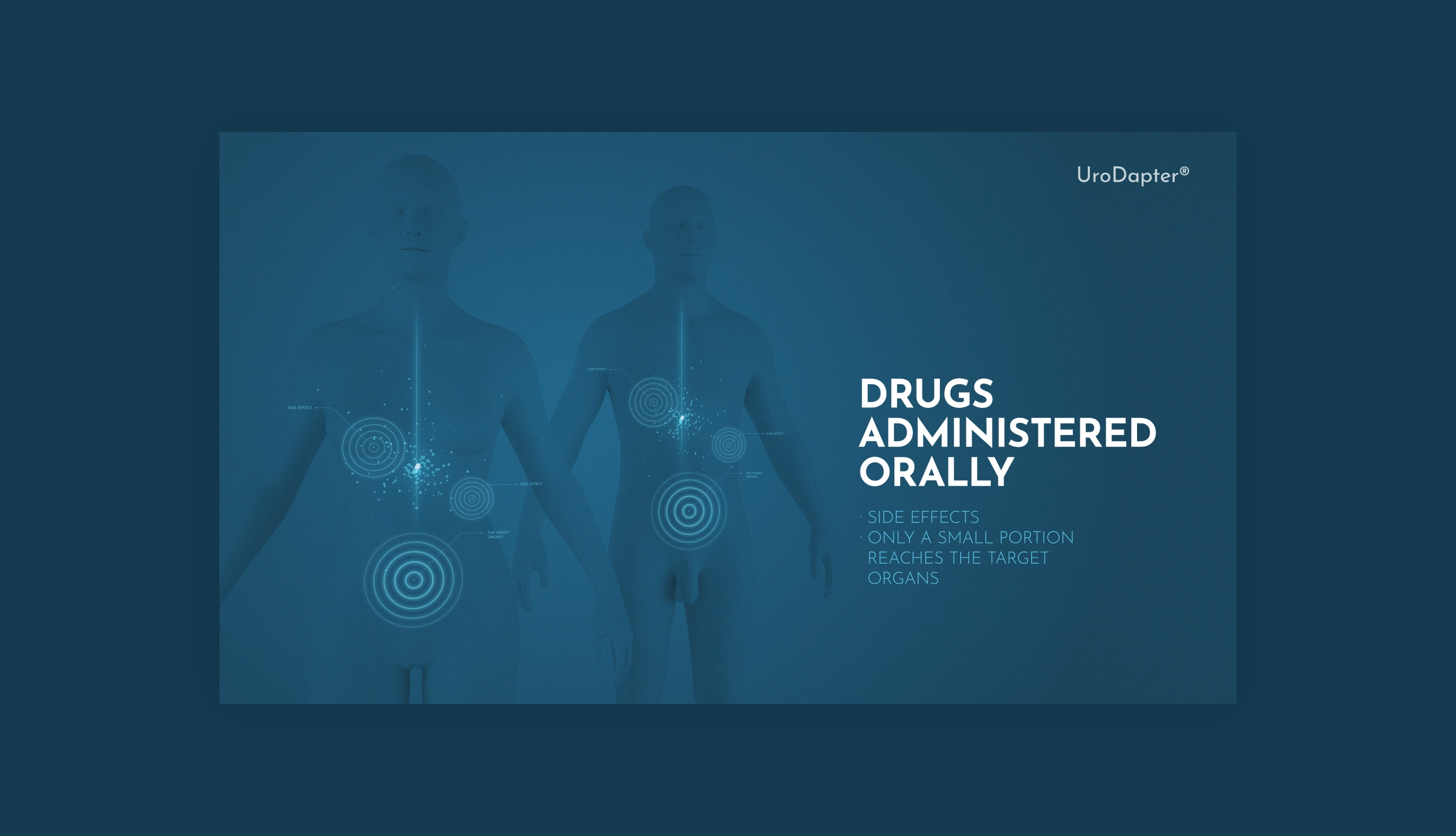 Simplifying Urological Care with UroDapter